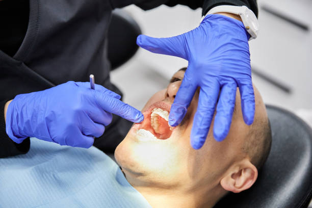 Best Walk-In Emergency Dentist in Little Cypress, TX